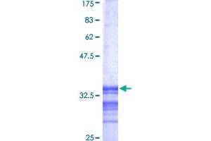 PGK2 Protein (AA 268-339) (GST tag)