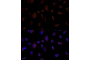Immunofluorescence analysis of U-2 OS cells using BRE Polyclonal Antibody (ABIN7265912) at dilution of 1:100 (40x lens). (BRE 抗体  (AA 51-229))