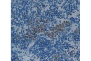 Figure. (beta-Thromboglobulin 抗体  (AA 46-107))