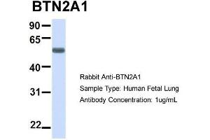 Host:  Rabbit  Target Name:  BTN2A1  Sample Type:  Human Fetal Lung  Antibody Dilution:  1. (BTN2A1 抗体  (N-Term))