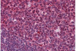 Human Tonsil: Formalin-Fixed, Paraffin-Embedded (FFPE) (SENP1 抗体  (C-Term))