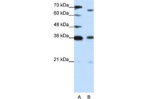 WB Suggested Anti-PRDM13 Antibody Titration:  1. (PRDM13 抗体  (C-Term))