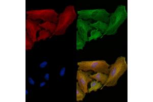 ABIN6262430 and ABIN6278873 staining  cells by IF/ICC.