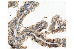 IHC analysis of Ch TOG/CKAP5 using anti-Ch TOG/CKAP5 antibody (ABIN7599106).