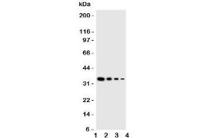Western blot testing of GCN2 antbody;  Lane 1: Recombinant mouse protein 10ng;  2: 5ng;  3: 2. (GCN2 抗体  (Middle Region))