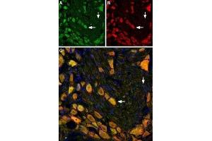 Immunohistochemistry (IHC) image for anti-Tachykinin Receptor 1 (TACR1) (AA 180-194), (Extracellular) antibody (Atto 488) (ABIN7043804)