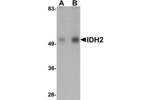 Western blot analysis of IDH2 in human heart tissue lysate with IDH2 antibody at (A) 1 and (B) 2 μg/ml. (IDH2 抗体  (N-Term))