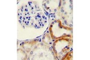 Immunohistochemistry analysis in formalin fixed and paraffin embedded human kidney tissue reacted with HYAL2 Antibody (C-term) followed which was peroxidase conjugated to the secondary antibody and followed by DAB staining. (HYAL2 抗体  (C-Term))