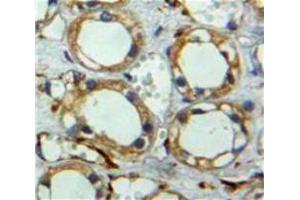 Used in DAB staining on fromalin fixed paraffin-embedded Kidney tissue (Neuregulin 2 抗体  (AA 101-211))