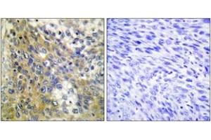 Immunohistochemistry (IHC) image for anti-Collagen, Type IV, alpha 6 (COL4a6) (AA 1201-1250) antibody (ABIN1534342)