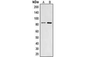 Western blot analysis of CNGA2 expression in HepG2 (A), A431 (B) whole cell lysates. (CNGA2 抗体  (Center))