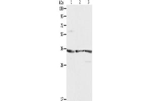 Western Blotting (WB) image for anti-Ribosomal Protein, Large, P0 (RPLP0) antibody (ABIN2422123) (RPLP0 抗体)