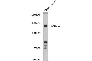 Western blot analysis of extracts of Mouse kidney, using C antibody (ABIN6127549, ABIN6137937, ABIN6137938 and ABIN6223226) at 1:500 dilution. (CARD10 抗体  (AA 863-1032))