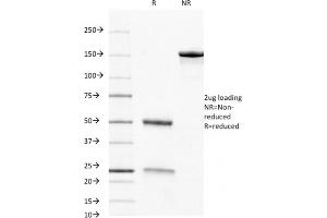 SDS-PAGE Analysis Purified CD8 Mouse Monoclonal Antibody (C8/468). (CD8 alpha 抗体)