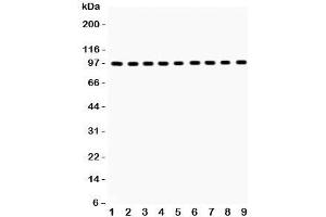 Western blot testing of GR antibody and Lane 1:  rat liver;  2: (r) brain;  3: (r) spleen;  4: human placenta;  5: (h) SMMC;  6: mouse HEPA;  7: (m) Neuro-2a;  8: (h) HeLa;  9: (r) PC12;  Predicted/Observed size: 91~94KD (GR (AA 20-199) 抗体)