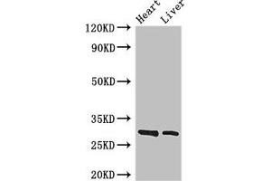 Western Blot Positive WB detected in: Mouse heart tissue, Mouse liver tissue All lanes: SPIC antibody at 3. (SPIC 抗体  (AA 1-248))