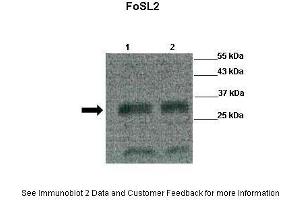 Lanes:  Lane 1: 15ul purified zebrafish FoSL2 protein Lane 2: 10ul purified zebrafish FoSL2 protein Primary Antibody Dilution:   1:500 Secondary Antibody:  Goat anti-rabbit HRP Secondary Antibody Dilution:   1:5000 Gene Name:  FOSL2 Submitted by:  Leila Jahangiri.