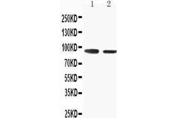 SLC9A2 antibody  (C-Term)