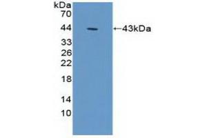 Detection of Recombinant ACTg1, Human using Polyclonal Antibody to Gamma Actin (ACTG) (Actin, gamma 1 抗体  (AA 1-375))