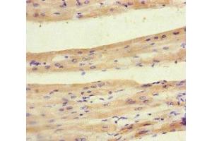 Immunohistochemistry of paraffin-embedded human heart tissue using ABIN7142008 at dilution of 1:100 (PDK4 抗体  (AA 143-333))