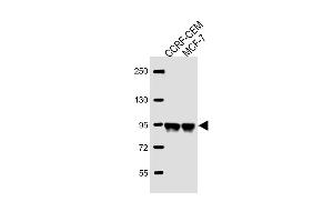 All lanes : Anti-AFTPH Antibody (C-term) at 1:2000 dilution Lane 1: CCRF-CEM whole cell lysate Lane 2: MCF-7 whole cell lysate Lysates/proteins at 20 μg per lane. (Aftiphilin 抗体  (C-Term))