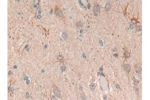 Immunohistochemistry (IHC) image for anti-Complement Component 6 (C6) (AA 682-934) antibody (ABIN7435277)