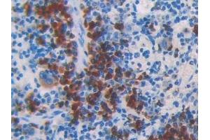 Immunohistochemistry (IHC) image for anti-Coagulation Factor V (F5) (AA 364-611) antibody (ABIN7438925)