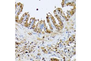 Immunohistochemistry of paraffin-embedded rat lung using SMN1 antibody (ABIN7270652) at dilution of 1:100 (40x lens). (SMN1 抗体  (AA 80-150))