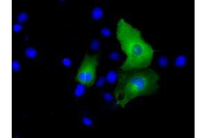 Anti-PSMC3 mouse monoclonal antibody (ABIN2453539) immunofluorescent staining of COS7 cells transiently transfected by pCMV6-ENTRY PSMC3 (RC201790). (PSMC3 抗体)