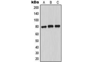Western blot analysis of MARCKS (pS163) expression in MCF7 PMA-treated (A), SP2/0 PMA-treated (B), PC12 PMA-treated (C) whole cell lysates. (MARCKS 抗体  (pSer163))