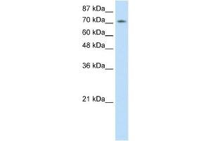 Western Blot showing ZNF527 antibody used at a concentration of 1-2 ug/ml to detect its target protein. (ZNF527 抗体  (C-Term))