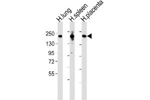 Western Blotting (WB) image for anti-Mannose Receptor, C Type 1 (MRC1) (AA 359-388), (N-Term) antibody (ABIN5530778)