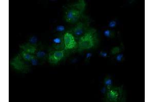 Image no. 3 for anti-Retinoic Acid Receptor Responder (Tazarotene Induced) 1 (RARRES1) antibody (ABIN1500602) (RARRES1 抗体)