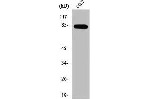 Western Blot analysis of Jurkat cells using SEMA4A Polyclonal Antibody (Sema4a 抗体  (Internal Region))