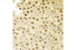 Immunohistochemistry of paraffin-embedded human liver injury using SFN Antibody. (14-3-3 sigma/SFN 抗体  (AA 1-248))