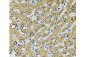 Immunohistochemistry of paraffin-embedded Human liver damage using SDC4 Polyclonal Antibody at dilution of 1:100 (40x lens). (SDC4 抗体)