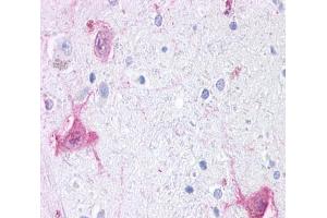 Anti-GPR6 antibody  ABIN1048844 IHC staining of human brain, neurons and glia.