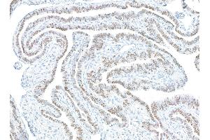 Immunohistochemistry (IHC) image for anti-Paired Box 8 (PAX8) antibody (ABIN7795602)