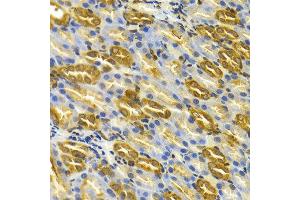 Immunohistochemistry of paraffin-embedded rat kidney using TCP1 antibody at dilution of 1:100 (x400 lens). (TCP1 alpha/CCTA 抗体)