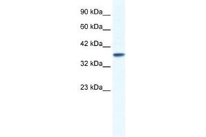 KCNK3 antibody used at 1. (KCNK3 抗体  (C-Term))