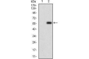 Western Blotting (WB) image for anti-DIS3-Like Exonuclease 2 (DIS3L2) (AA 27-250) antibody (ABIN1724900)