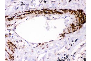 Immunohistochemistry (IHC) image for anti-Protein tyrosine Phosphatase, Non-Receptor Type 11 (PTPN11) (AA 69-99), (N-Term) antibody (ABIN3043912)