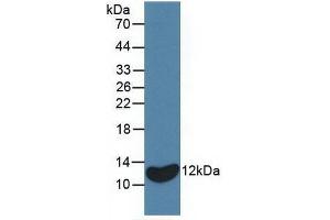Detection of Recombinant IL8, Equine using Monoclonal Antibody to Interleukin 8 (IL8) (IL-8 抗体  (AA 23-101))