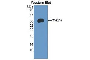 Western Blot; Sample: Recombinant protein. (ENPP2 抗体  (AA 637-905))