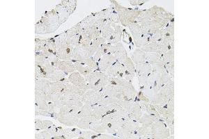 Immunohistochemistry of paraffin-embedded mouse heart using GTF2H2 antibody (ABIN5975366) at dilution of 1/100 (40x lens). (GTF2H2 抗体)