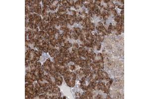 Immunohistochemical staining of human pancreas with UFL1 polyclonal antibody  shows strong cytoplasmic positivity in exocrine glandular cells at 1:50-1:200 dilution. (UFL1 抗体)
