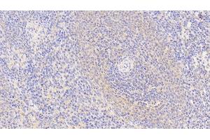Detection of S100Z in Human Spleen Tissue using Polyclonal Antibody to S100 Calcium Binding Protein Z (S100Z) (S100Z 抗体  (AA 1-99))