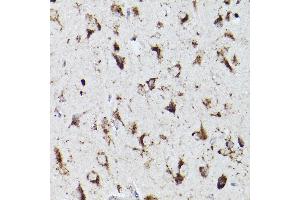 Immunohistochemistry (IHC) image for anti-Prosaposin (PSAP) (AA 60-310) antibody (ABIN3022606)