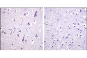 Immunohistochemistry analysis of paraffin-embedded human brain, using GFAP (Phospho-Ser38) Antibody. (GFAP 抗体  (pSer38))
