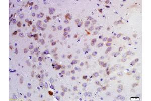 Formalin-fixed and paraffin embedded rat brain labeled with Rabbit Anti-KDM1 Polyclonal Antibody, Unconjugated 1:200 followed by conjugation to the secondary antibody and DAB staining (LSD1 抗体  (AA 101-200))
